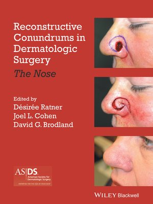 cover image of Reconstructive Conundrums in Dermatologic Surgery